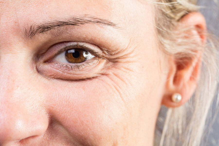 Wrinkles around a woman's eye as she wonders how to minimize it